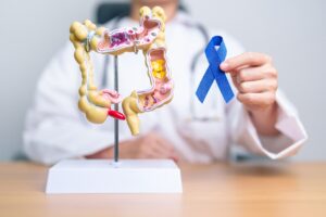 Colorectal Cancer Treatments in Mumbai